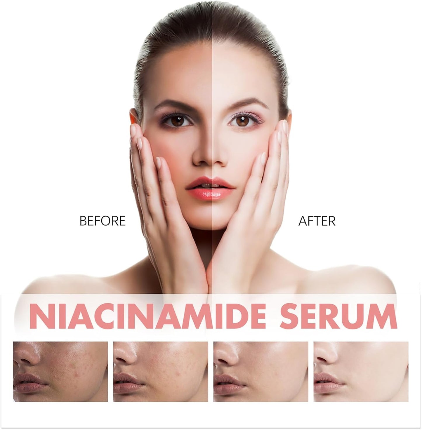Peach 70 Niacin Serum, Peach 70% Niacinamide Serum,Hydrating Face Serum,Daily Clean Beauty Skincare,Face Serum for Women Korean Skincare Set for Teenagers Adult