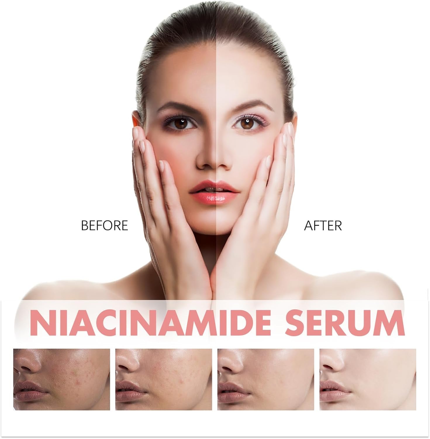 Peach 70 Niacin Serum, Peach 70% Niacinamide Serum,Hydrating Face Serum,Daily Clean Beauty Skincare,Face Serum for Women Korean Skincare Set for Teenagers Adult
