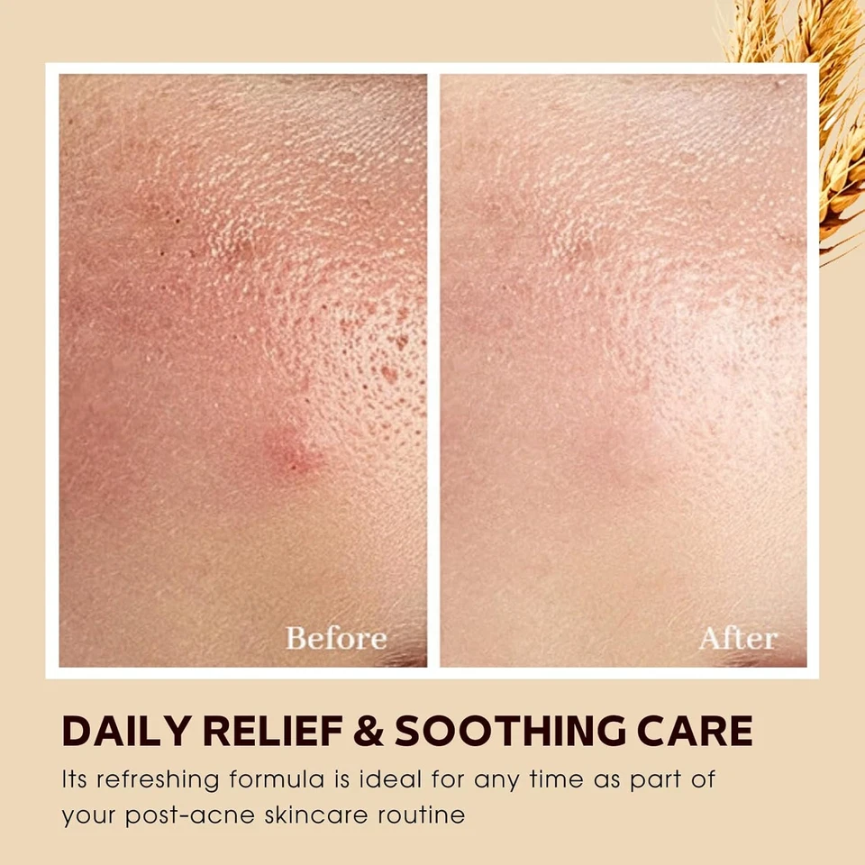 Natural Rice Face Moisturiser Cream